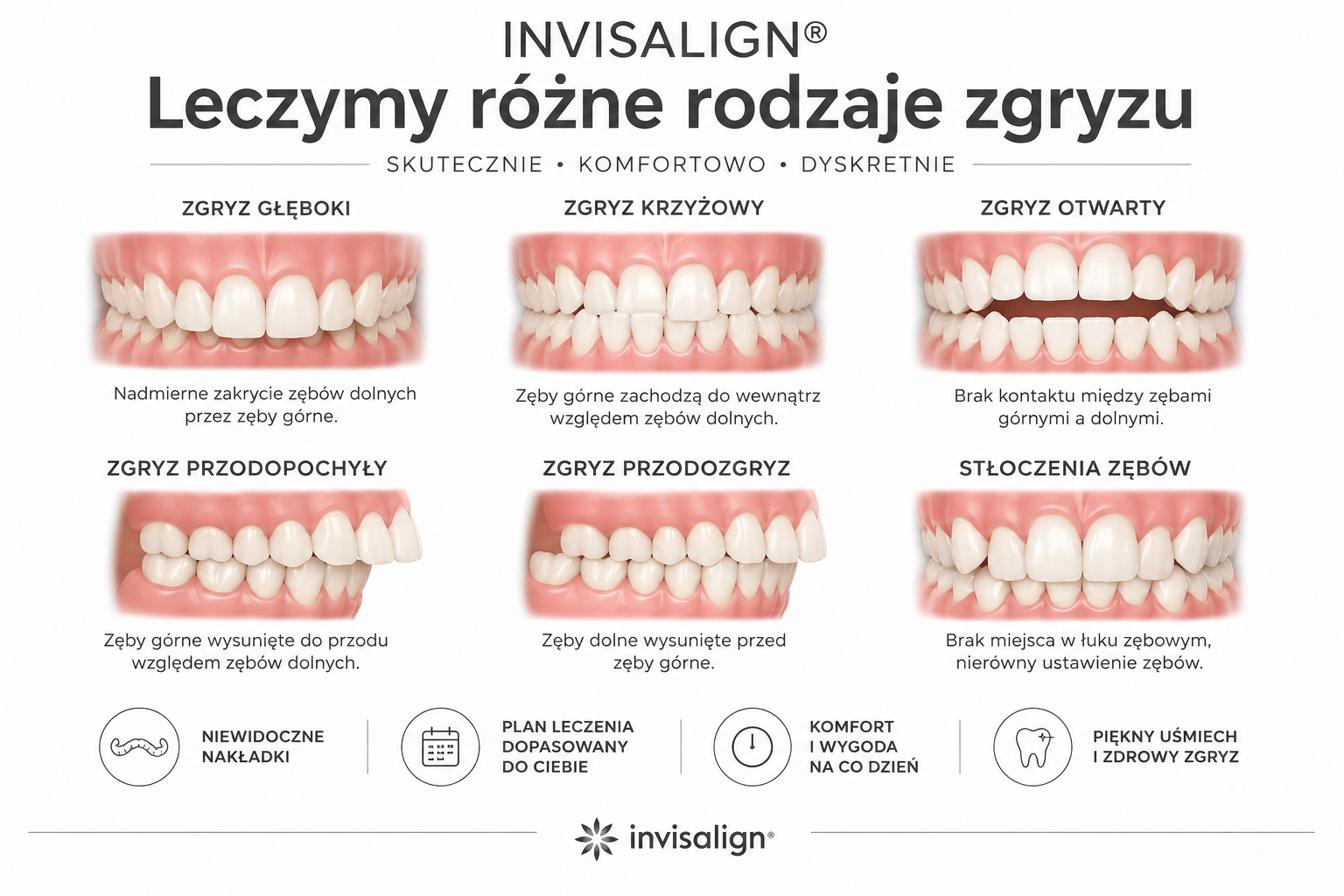 invisalign